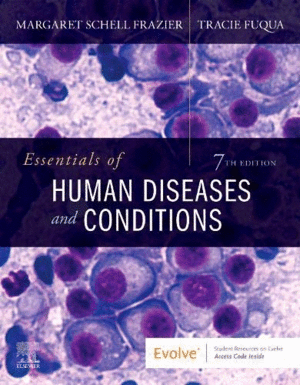 EESSENTIALS OF HUMAN DISEASES AND CONDITIONS. 7TH EDITION