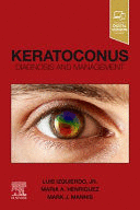 KERATOCONUS. DIAGNOSIS AND MANAGEMENT