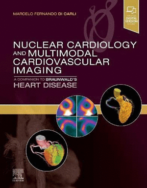 NUCLEAR CARDIOLOGY AND MULTIMODAL CARDIOVASCULAR IMAGING. A COMPANION TO BRAUNWALD'S HEART DISEASE