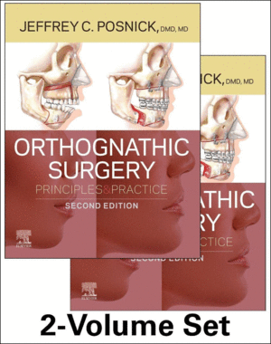 ORTHOGNATHIC SURGERY. PRINCIPLES AND PRACTICE.  2 VOLUME SET. 2ND EDITION