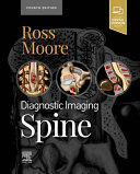 DIAGNOSTIC IMAGING. SPINE. 4TH EDITION