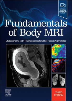 FUNDAMENTALS OF BODY MRI , 3RD EDITION