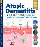 ATOPIC DERMATITIS. INSIDE OUT OR OUTSIDE IN