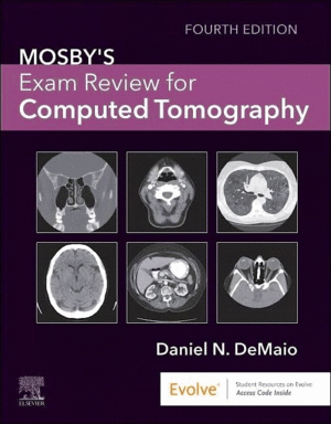 MOSBY'S EXAM REVIEW FOR COMPUTED TOMOGRAPHY.  4TH EDITION