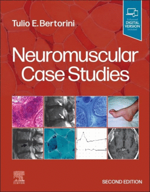 NEUROMUSCULAR CASE STUDIES. 2ND EDITION