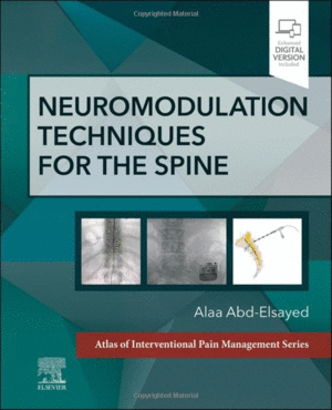 NEUROMODULATION TECHNIQUES FOR THE SPINE. A VOLUME IN THE ATLAS OF INTERVENTIONAL PAIN MANAGEMENT SERIES
