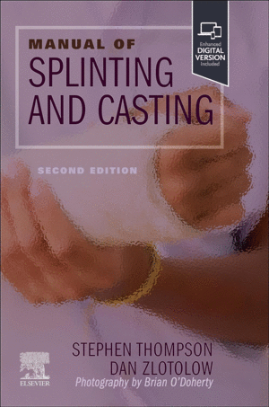 MANUAL OF SPLINTING AND CASTING. 2ND EDITION