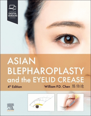 ASIAN BLEPHAROPLASTY AND THE EYELID CREASE, 4TH EDITION