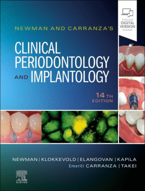 NEWMAN AND CARRANZA'S CLINICAL PERIODONTOLOGY AND IMPLANTOLOGY. 14TH EDITION