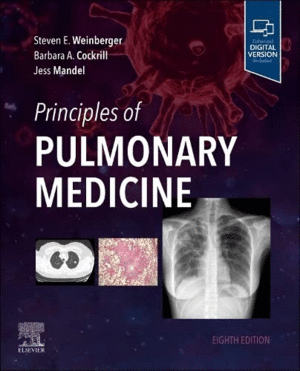 PRINCIPLES OF PULMONARY MEDICINE. 8TH EDITION