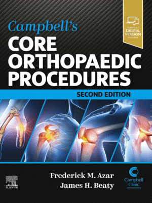 CAMPBELL'S CORE ORTHOPAEDIC PROCEDURES. 2ND EDITION