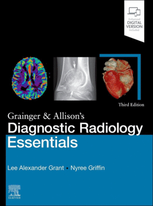 GRAINGER & ALLISON'S DIAGNOSTIC RADIOLOGY ESSENTIALS. 3RD EDITION