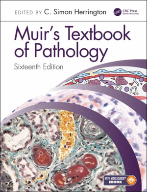 MUIR'S TEXTBOOK OF PATHOLOGY. 16TH EDITION. (SOFTCOVER+ EBOOK)