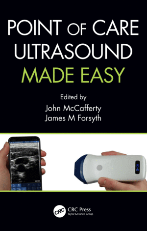 POINT OF CARE ULTRASOUND MADE EASY. (PAPERBACK)