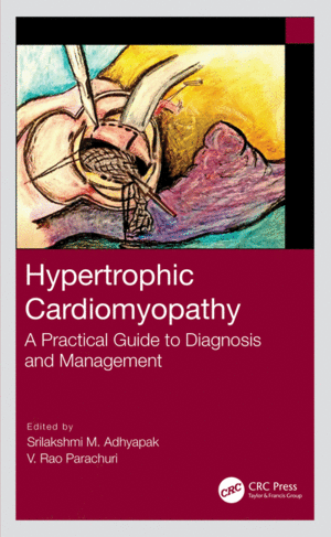 HYPERTROPHIC CARDIOMYOPATHY. A PRACTICAL GUIDE TO DIAGNOSIS AND MANAGEMENT. (PAPERBACK)