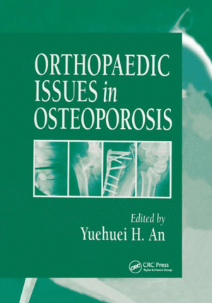 ORTHOPAEDIC ISSUES IN OSTEOPOROSIS