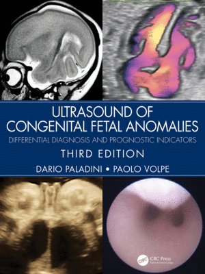 ULTRASOUND OF CONGENITAL FETAL ANOMALIES. DIFFERENTIAL DIAGNOSIS AND PROGNOSTIC INDICATORS. 3RD EDITION