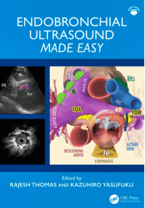 ENDOBRONCHIAL ULTRASOUND MADE EASY