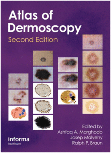 AN ATLAS OF DERMOSCOPY, SECOND EDITION
