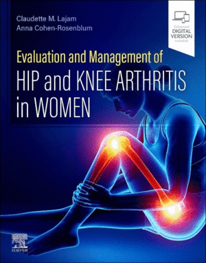 EVALUATION AND MANAGEMENT OF HIP AND KNEE ARTHRITIS IN WOMEN