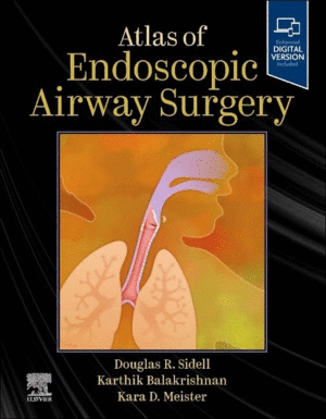 ATLAS OF ENDOSCOPIC AIRWAY SURGERY