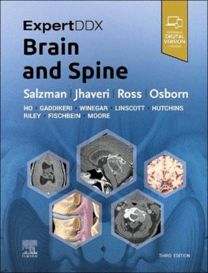 EXPERTDDX. BRAIN AND SPINE. 3RD EDITION