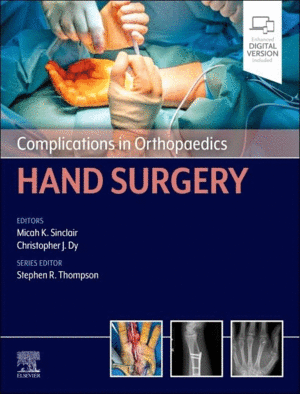 COMPLICATIONS IN ORTHOPAEDICS. HAND SURGERY