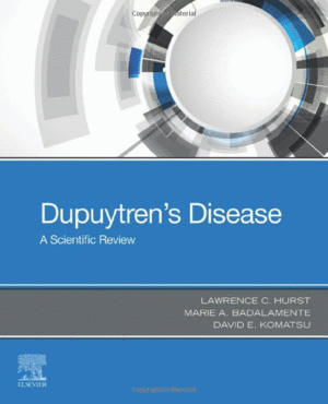 DUPUYTREN'S DISEASE. A SCIENTIFIC REVIEW