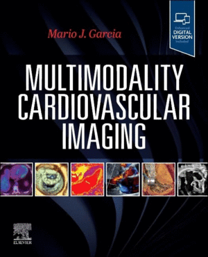 MULTIMODALITY CARDIOVASCULAR IMAGING