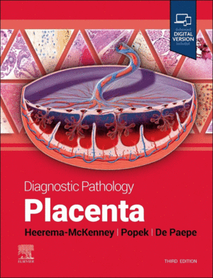 DIAGNOSTIC PATHOLOGY: PLACENTA. 3RD EDITION