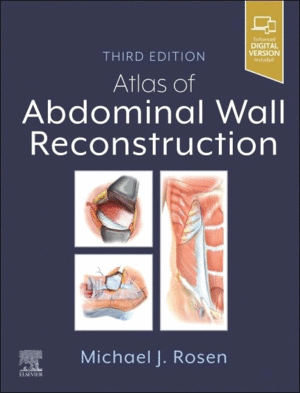 ATLAS OF ABDOMINAL WALL RECONSTRUCTION. 3RD EDITION