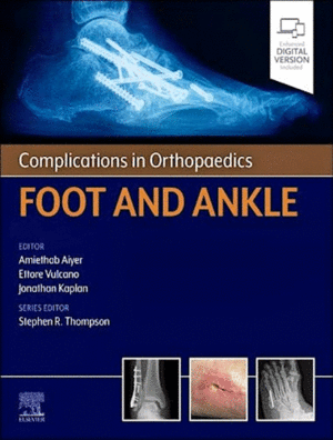 COMPLICATIONS IN ORTHOPAEDICS: FOOT AND ANKLE