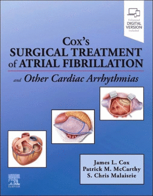 COX�S SURGICAL TREATMENT OF ATRIAL FIBRILLATION