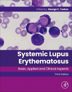 SYSTEMIC LUPUS ERYTHEMATOSUS. BASIC, APPLIED AND CLINICAL ASPECTS. 3RD EDITION