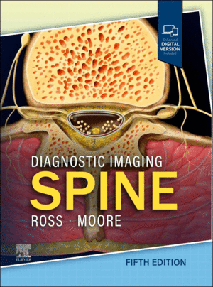 DIAGNOSTIC IMAGING: SPINE. 5TH EDITION