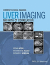LIVER IMAGING. MRI WITH CT CORRELATION