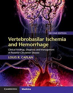 VERTEBROBASILAR ISCHEMIA AND HEMORRHAGE