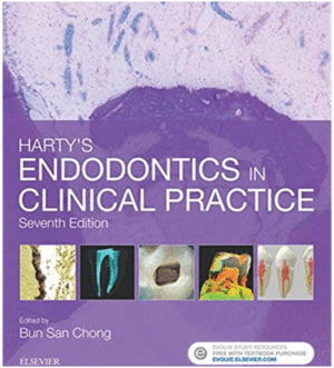 HARTY'S ENDODONTICS IN CLINICAL PRACTICE, 7TH EDITION
