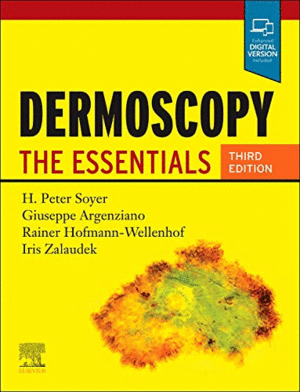 DERMOSCOPY. THE ESSENTIALS. 3RD EDITION