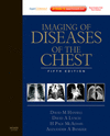 IMAGING OF DISEASES OF THE CHEST EXPERT CONSULT