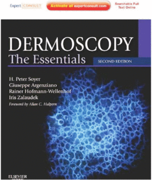DERMOSCOPY, 2ND EDITION. THE ESSENTIALS: EXPERT CONSULT - ONLINE AND PRINT