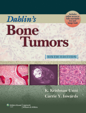 DAHLIN'S BONE TUMORS. 6TH EDITION