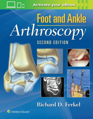 FOOT & ANKLE ARTHROSCOPY. 2ND EDITION
