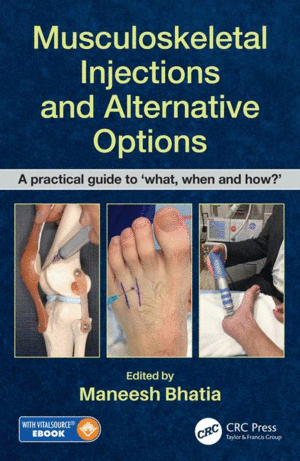 MUSCULOSKELETAL INJECTIONS AND ALTERNATIVE OPTIONS. A PRACTICAL GUIDE TO WHAT, WHEN AND HOW?