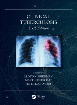 CLINICAL TUBERCULOSIS. 6TH EDITION