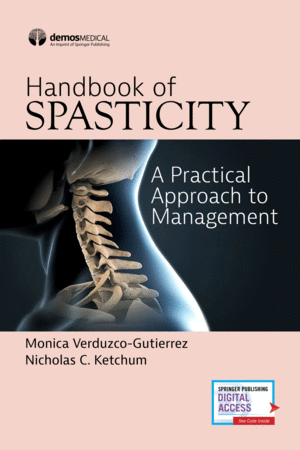 HANDBOOK OF SPASTICITY A PRACTICAL APPROACH TO MANAGEMENT