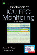 HANDBOOK OF ICU EEG MONITORING. 2ND EDITION