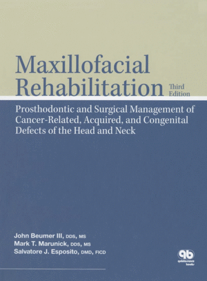 MAXILLOFACIAL REHABILITATION. SURGICAL AND PROSTHODONTIC MANAGEMENT OF CANCER-RELATED, ACQUIRED, AND CONGENITAL DEFECTS OF THE HEAD AND NECK. 3RD EDIT