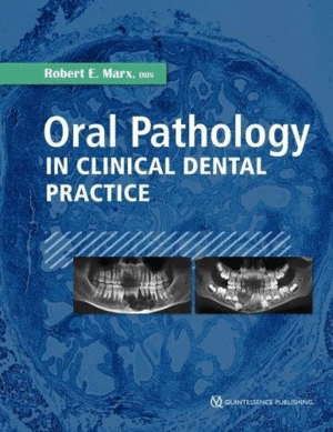 ORAL PATHOLOGY IN CLINICAL DENTAL PRACTICE