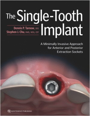 THE SINGLE-TOOTH IMPLANT A MINIMALLY INVASIVE APPROACH FOR ANTERIOR AND POSTERIOR EXTRACTION SOCKETS